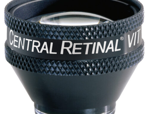 CENTRAL RETINA